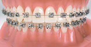 Orthodontics